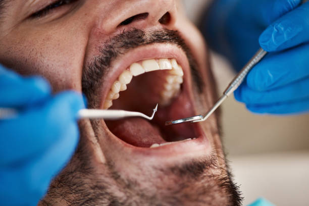 Best Cracked Tooth Emergency Dentist  in Vley Grande, AL