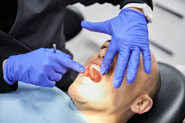 Dentist for Dental Trauma in AL